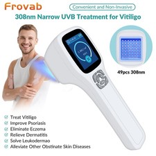 308nm Excimer Uvb Light Therapy 5-40mW/cm Phototherapy Device for Skin Diseases