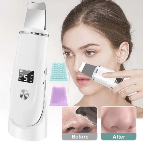 Ultraschallpeelinggerät Porenreiniger Skin Scrubber Ultraschall Peeling Retoo DE - Bild 8 von 15