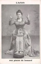 Lobster Claw Carnival Sideshow Freak 1910 RPPC Photo Postcard COPY