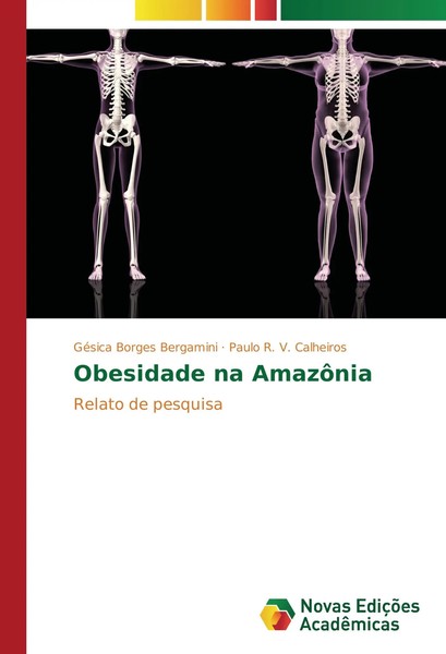 GéSica Borges Bergamini (U. A.) | Obesidade Na AmazôNia | Taschenbuch (2016)-image