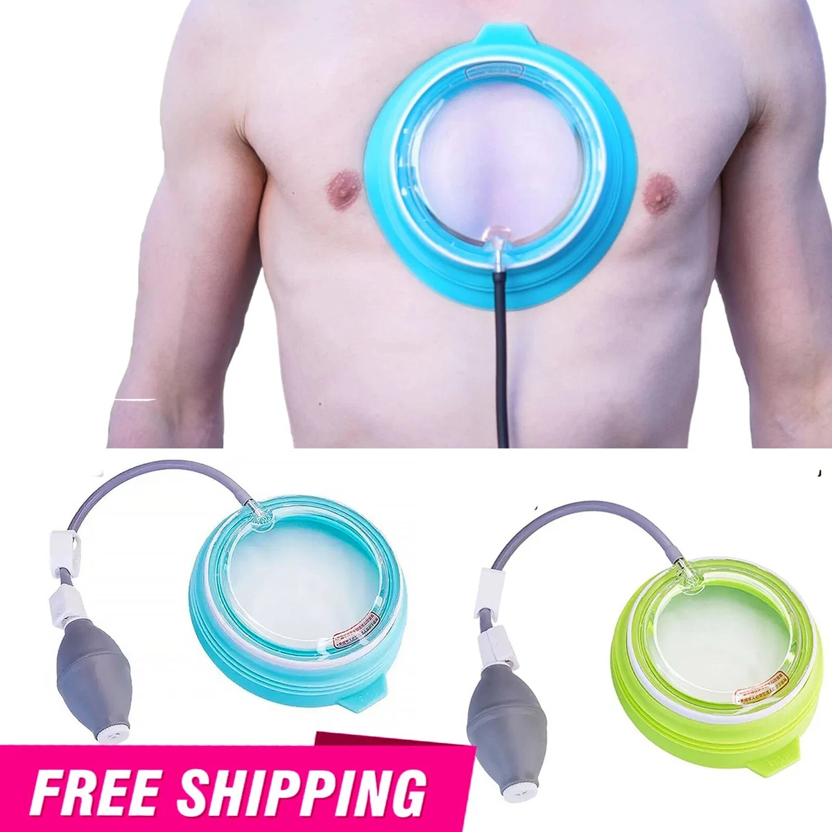 Vacuum Bell For Pectus Excavatum PECTUS Healing Pectus