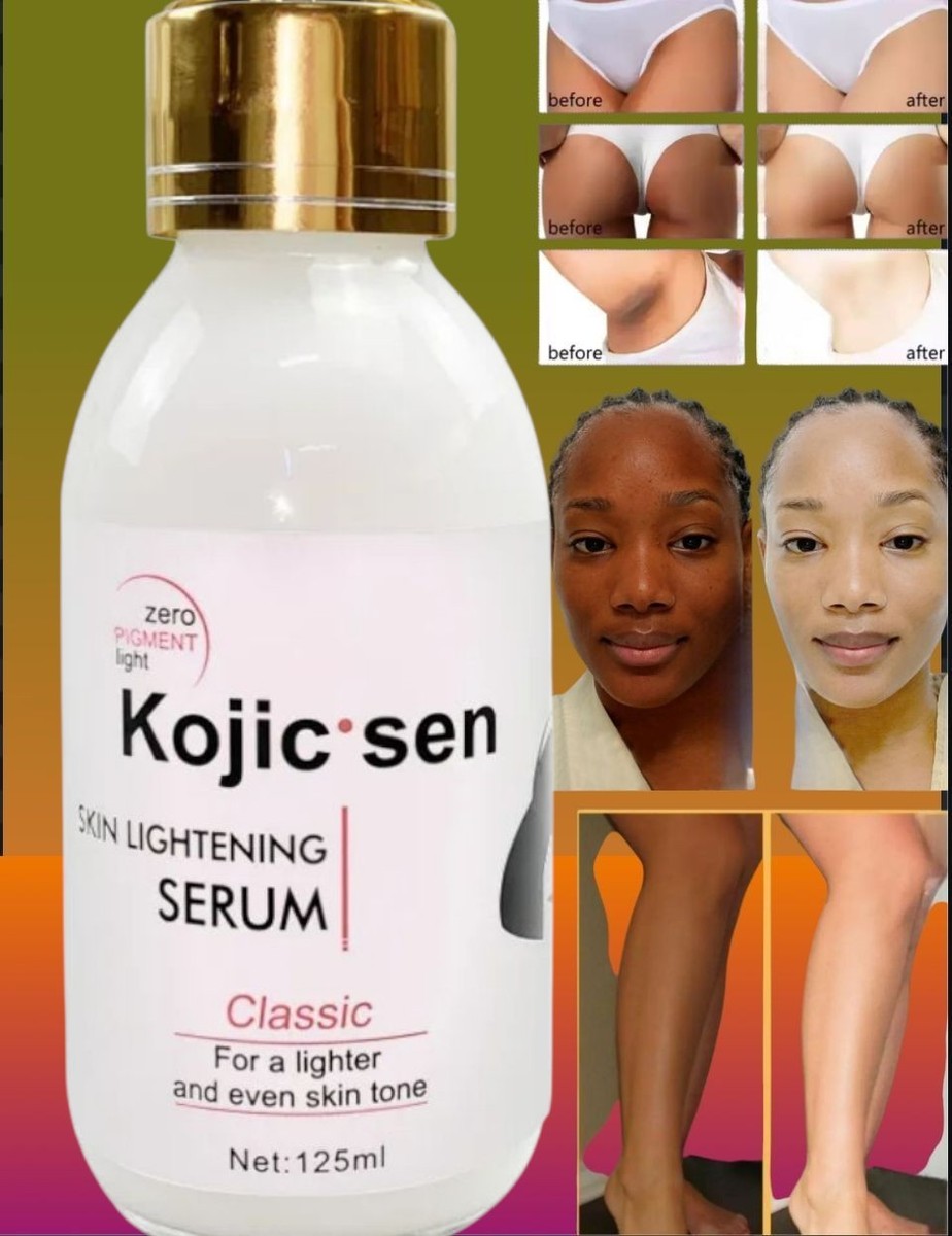 Kojic San Brightening Serum, Skin Darkspots Blemish Eraser 125ml