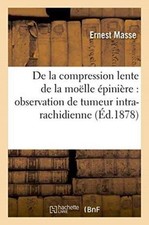 MASSE-E - De la compression lente de la molle pinire   - New paperb - X555z