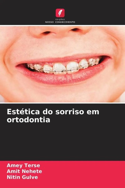 Amey Terse (U. A.) | EstéTica Do Sorriso Em Ortodontia | Taschenbuch (2023)-image