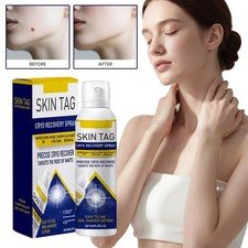 Chill Erase Bump Renewal Spray Precise Cryo Recover NeAMK Targets RootWarts V6X5