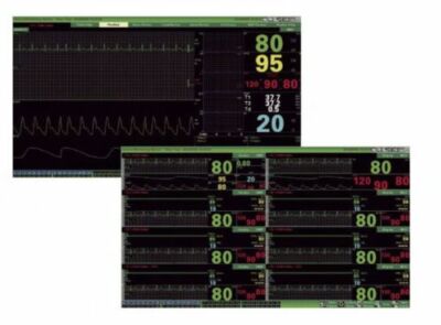 CONTEC Central Monitoring System,Networked to CMS9000 patient monitor