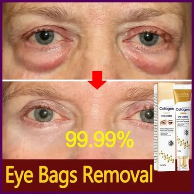 Fast Instant Eye Bag Removal Cream Collagen Removal Wrinkles Firming Skin...