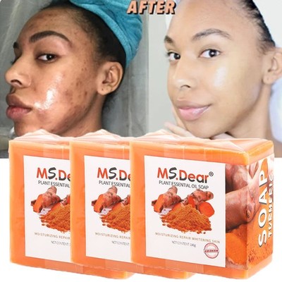 1-3x Tumeric Soap Skin Whitening Dark Spots lightening Acne Brightening Turmeric