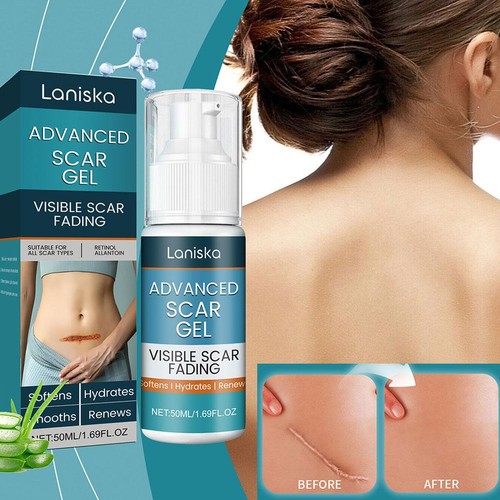 50ml Scar Fading Acne Cream Silicone Removal Fade Old New Treatments Body - Picture 6 of 12