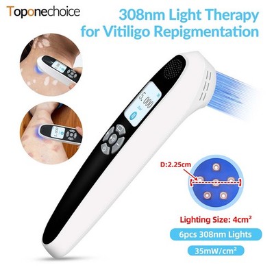308nm Excimer UVB Light Therapy Non-Invasive Targeted Treatment Adjustable Dose