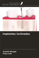 Srashti Mangal (U. A.) | Implantes Inclinados | Taschenbuch | Spanisch (2024)