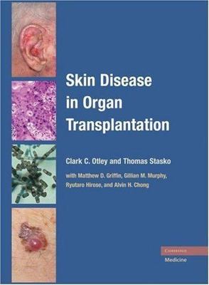 Skin Disease in Organ Transplantation Otley Stasko Hardback 9780521870672
