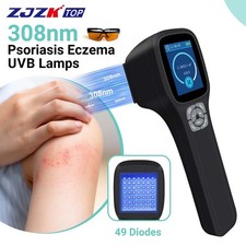 Portable 308nm Narrowband UVB Light Therapy Device for Targeted Skin Treatment