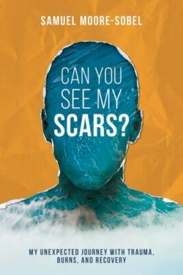 Can You See My Scars? Samuel Moore-Sobel hardcover Used - Very Good