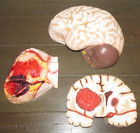 Anatomical Human Heart Brain Model Medical Teaching Patient Counseling Resin — photo 1