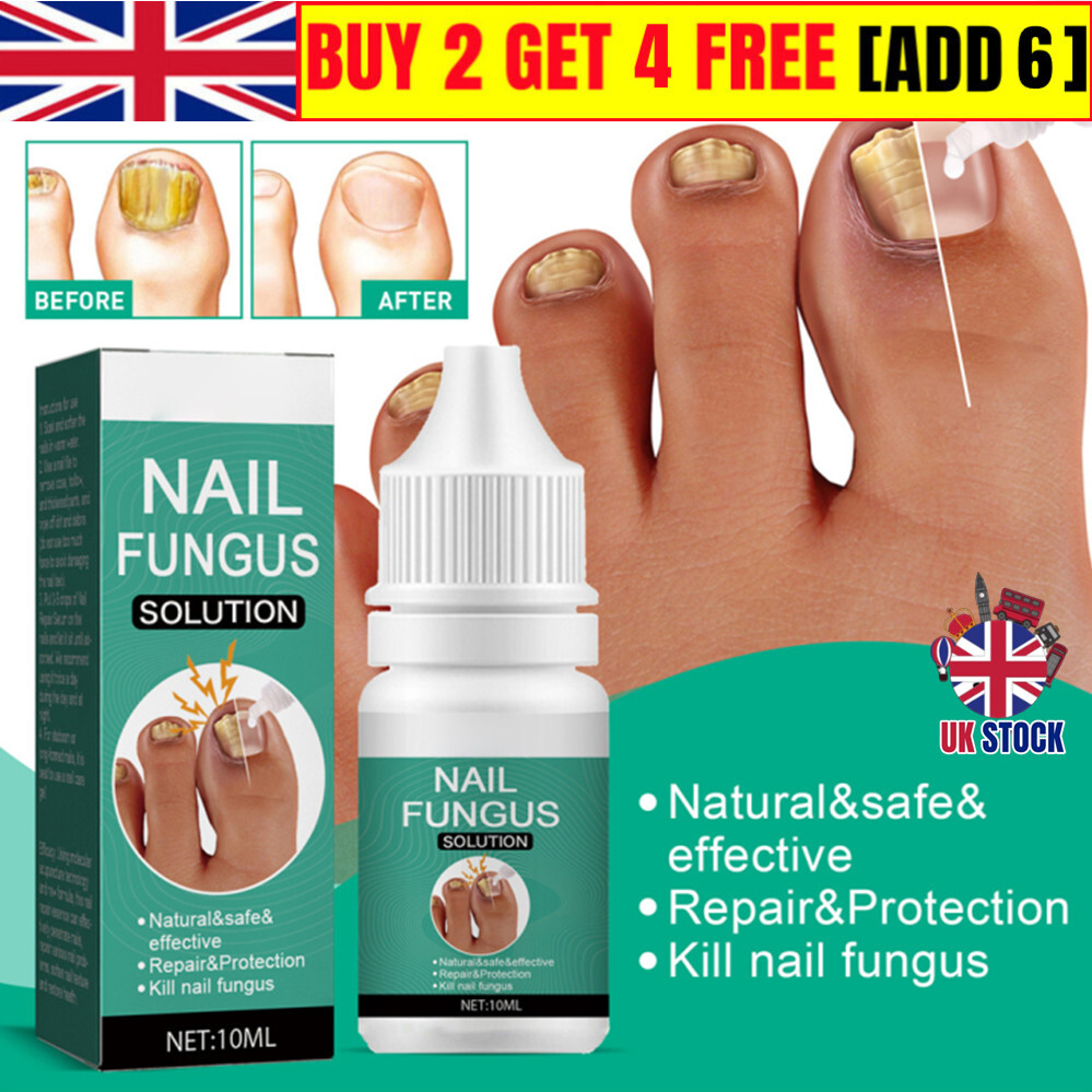 2024 Fungal Nail Treatment For Toenails Extra StrongNail Fungus