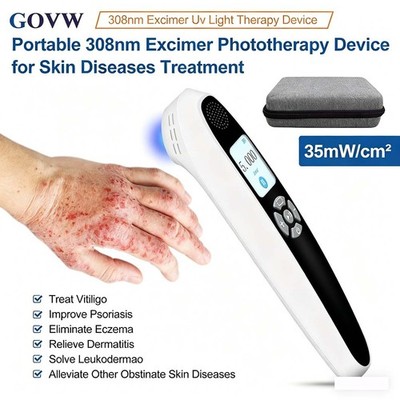 308nm UVB Excimer Phototherapy 35mW/cm² for Eczema & Skin Health Relief Home Use