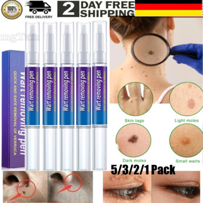 2024 Warzen Entfernung Haut Tag Behandlung Creme Wart Warze Entferner Pen DE