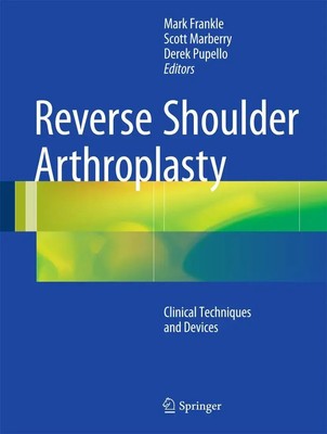 Mark Frankle (u. a.) | Reverse Shoulder Arthroplasty | Buch | Englisch (2015)