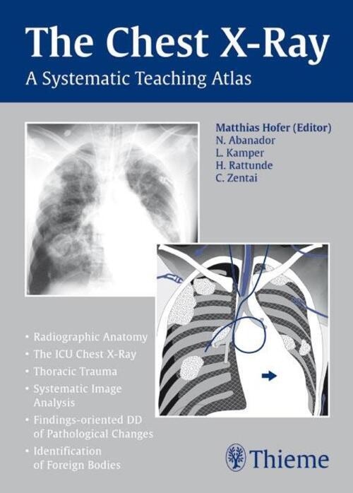 Thumbnail - Matthias Hofer | Chest X-ray Trainer | Taschenbuch | Englisch (2006) |