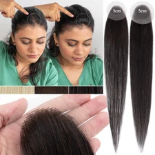 Full Lace Base Cover-up Alopecia 100% Virgin Human Hair Patches Pieces Topper