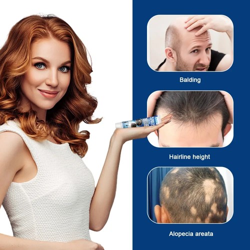 New 20g Alopecia Treatment Cream Hair Growing Prevent Alopecia Baldness Regrowth - Picture 6 of 12