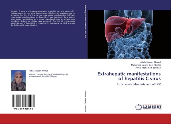Extrahepatic Manifestations Of Hepatitis C Virus Nabila Hassan Ahmed-image