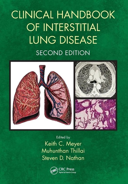 Clinical Handbook Of Interstitial Lung Disease | Keith C. Meyer (U. A.) | Buch-image