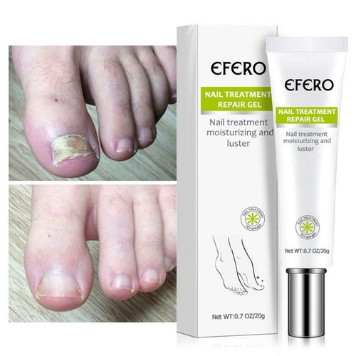 EFERO Nail Repair Essence Remove Onychomycosis Serum Nail Fungal HOT - Picture 8 of 12