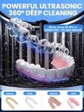 Ultrasonic Retainer Cleaner Pod Machine: Nicwell 200ML Denture Cleaner NEW