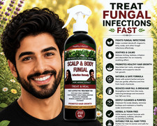 Image of Potent Remedy Scalp | Body Fungal Infection Fast - PURE HERBAL EXTRACT 250 ML