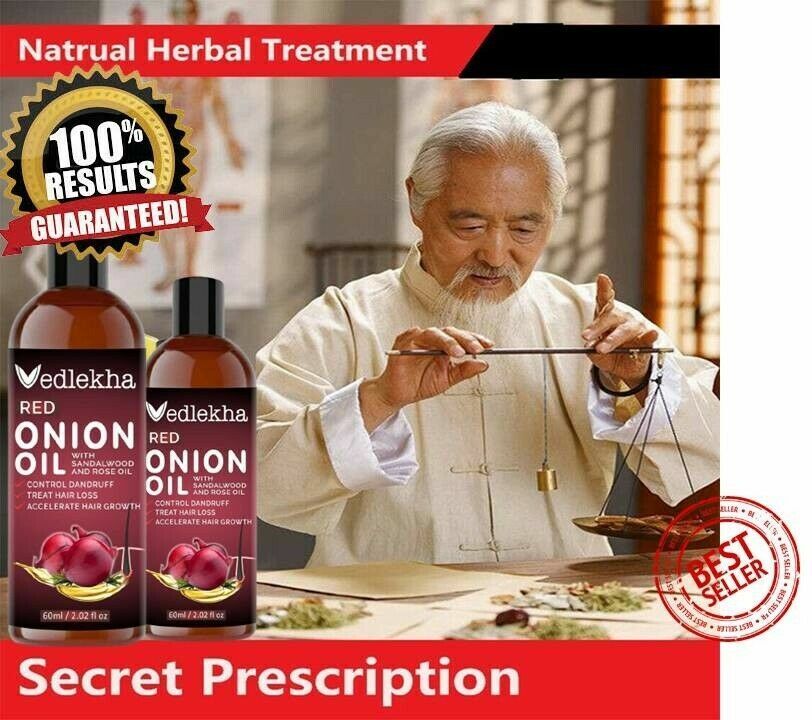 Hair Loss treatment Fast hair growth serum Oil Natural essentialOil men women.. | eBay Hair Loss treatment Fast hair growth serum Oil Natural essentialOil men women.. | eBay