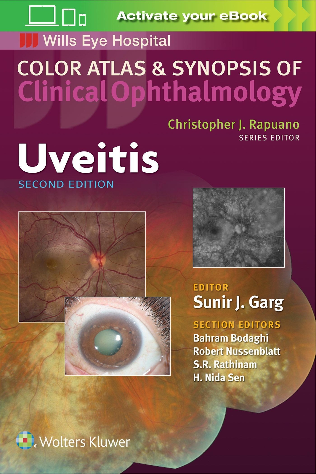 Thumbnail - Uveitis (color Atlas And Synopsis Of Clinical Ophthalmology) | Sunir