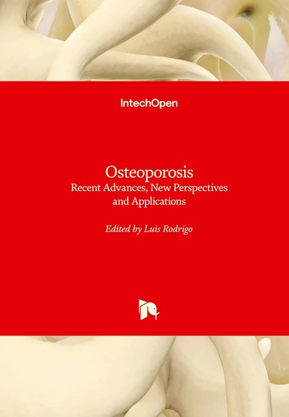 Luis Rodrigo | Osteoporosis | Buch | Englisch (2021) | Gebunden | IntechOpen-image