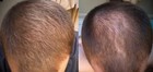 Foto 2 di 4