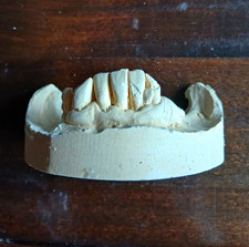 Dental Plaster Cast Lower Jaw Model Mould Medical Halloween Goth Curio Oddity
