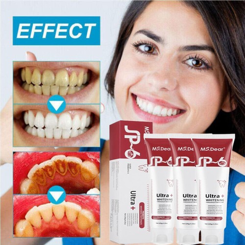 3PACK SP-6 Probiotic Whitening Toothpaste Teeth Whitening Toothpaste Oral Care