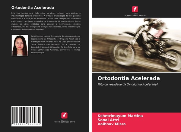 Ortodontia Acelerada Mito Ou Realidade Da Ortodontia Acelerada? Martina (U. A.)-image