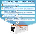 CO2 Fractional Laser Machine Skin Tightening Acne Scar Removal Skin Rejuvenation — photo 7