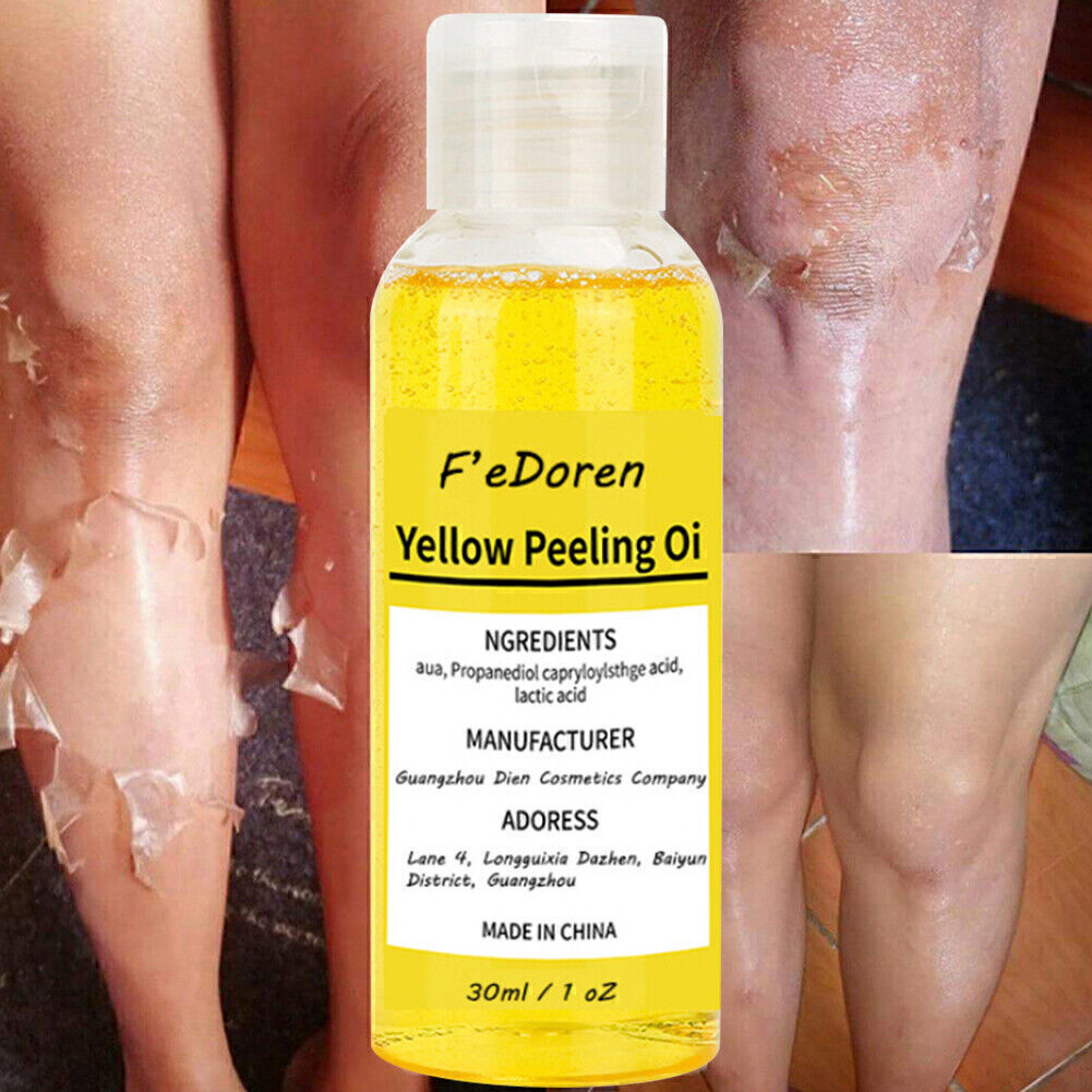Yollow Peeling Oil - Huile De Peeling Jaune Original Extra Fort 100 Ml