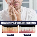 2pcs 100g Ginseng Propolis Oral Salbe Entfernen Sie Fleck Zahnpasta