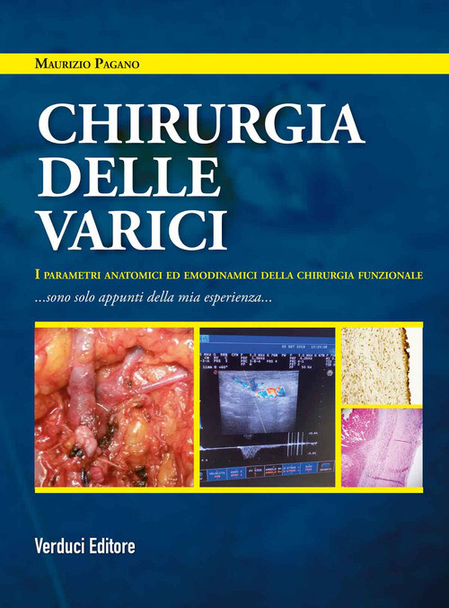 CHIRURGIA DELLE VARICI. I PARAMETRI ANATOMICI ED EMODINAMICI DELLA CHI PAGANO MA