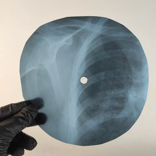 VELVET UNDERGROUND SUNDAY MORNI X-Ray USSR Record Roentgen Bone Ribs Music Vinyl