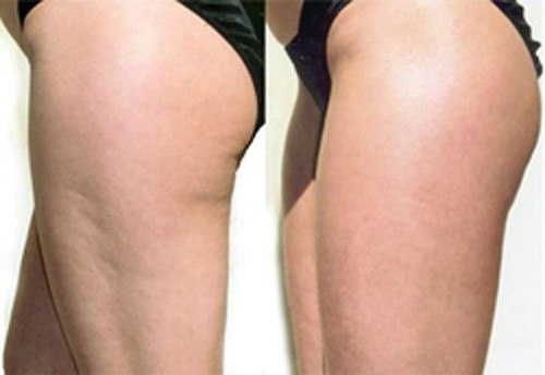ALL NEW MADE IN THE USA 100% Natural BUTT BOOTY CREAM FREE SHIPPING - Picture 8 of 8