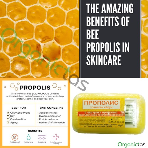 Propolis Soaps Anti-Bacterial Anti-Fungal Anti-Inflammatory Dandruff 1 - 5 pcs. - Afbeelding 1 van 12