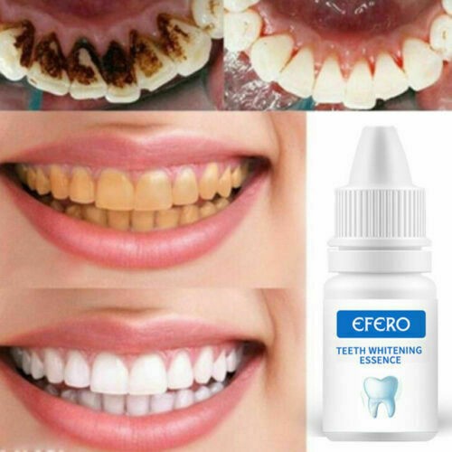 Teeth Whitening Essence Serum Gel Oral Hygiene Dental Care Plaque Clean Remove - Picture 3 of 12