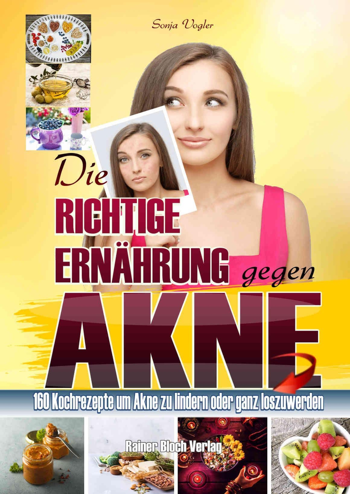 Thumbnail - Die Richtige Ernährung Gegen Akne Sonja Vogler Taschenbuch 172 S.
