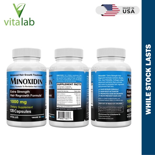MINOXIDINA 1000mg Crecimiento del Cabello 120 Comprimidos Extra Fuerza Hombres Mujeres Recrecimiento EE. UU. - Imagen 9 de 21