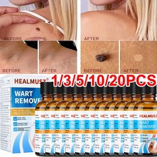 Wart Remover Liquid Skin Tag Mole Remover Eliminate Foot Corn Warts Unisex 30ML
