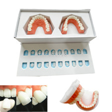 Plantilla de carilla compuesta dental modelo práctica carillas dentista enseñanza 1 juego
